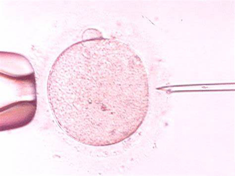 試管女性在取卵前需要做什么？