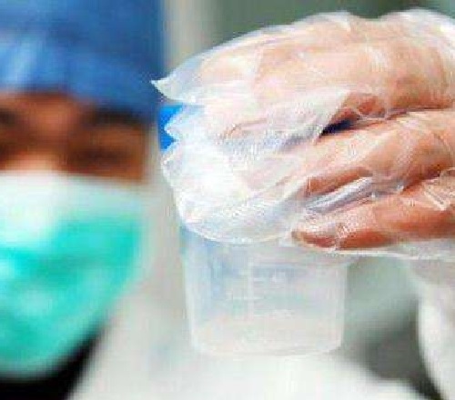 男方在做試管嬰兒時(shí)需要做哪些檢查？