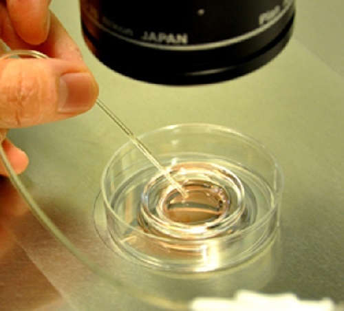 試管嬰兒如何降低胚胎碎片率？