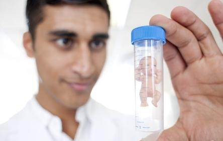 如何防止做試管嬰兒后發(fā)生腹水？