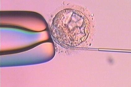 促排取卵會(huì)不會(huì)痛？對(duì)身體有沒(méi)有影響？