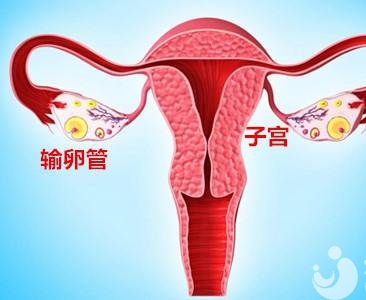 輸卵管積水是先做通水手術(shù)，還是試管嬰兒？