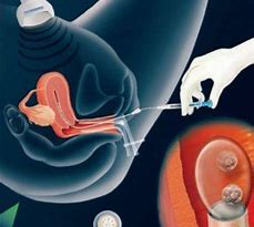 做一次試管嬰兒要用很長時(shí)間？