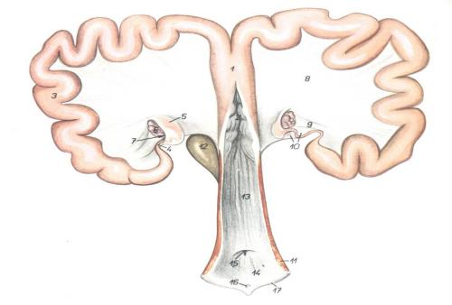做試管嬰兒前要先處理輸卵管積水嗎？