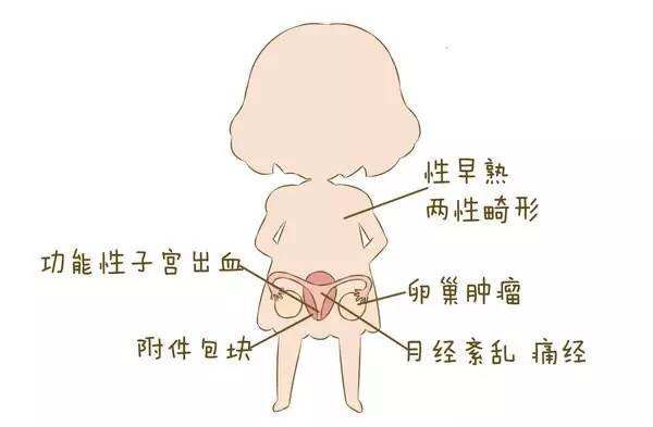 護理子宮，讓女性遠離婦科疾病