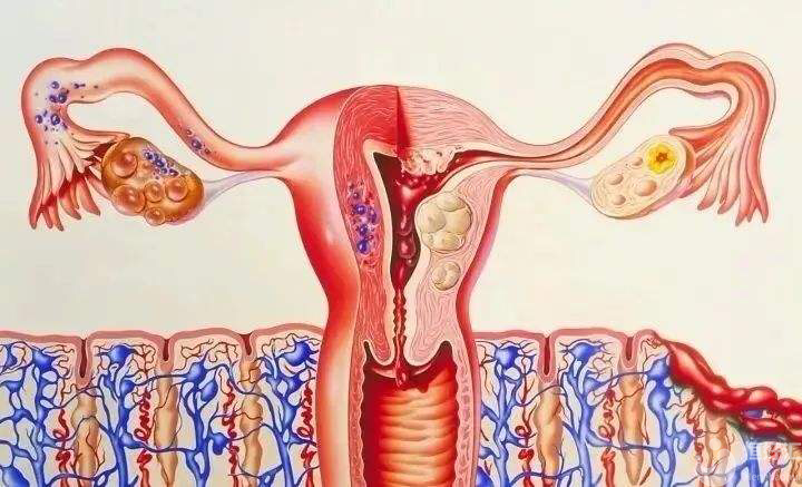 子宮內(nèi)膜增生，會影響懷孕嗎？