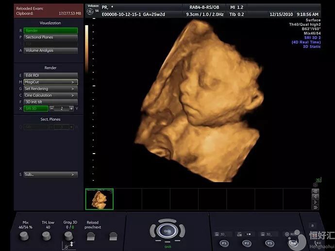 四維彩超，寶寶人生的第一張照片