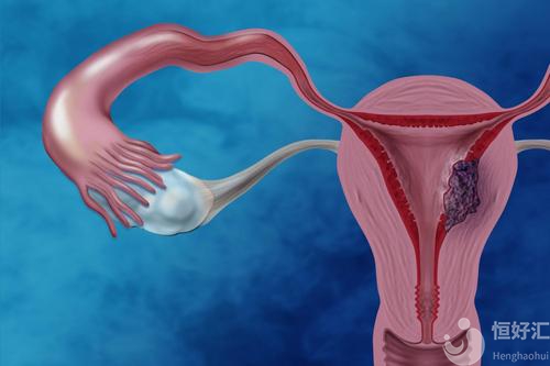子宮內(nèi)膜薄能否做試管治療？要怎么辦？