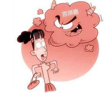 不用檢查也能知道是宮頸癌，看哪些癥狀？