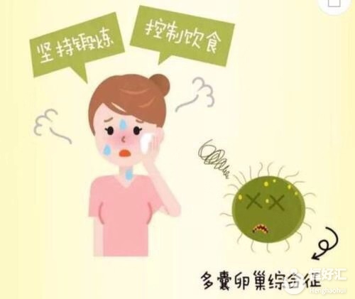 多囊卵巢綜合征，應(yīng)該如何治療？