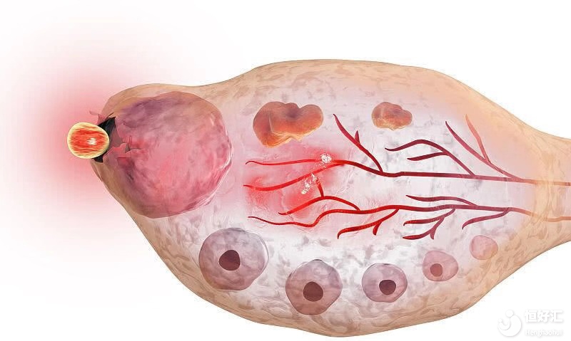 卵巢功能減退，是誰(shuí)的錯(cuò)？