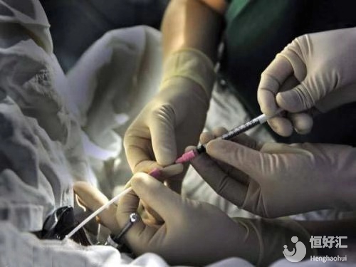 取卵過(guò)后，卵巢多久能恢復(fù)？