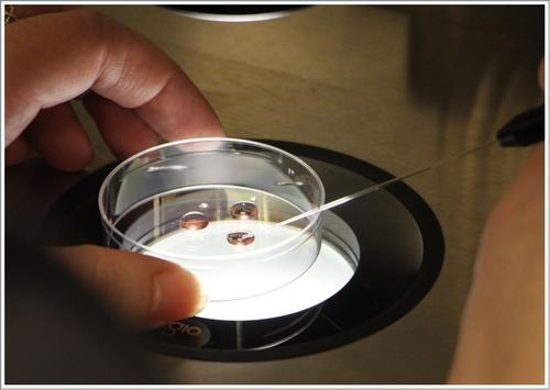 胚胎移植后有失眠現(xiàn)象？教你幾個解決方法