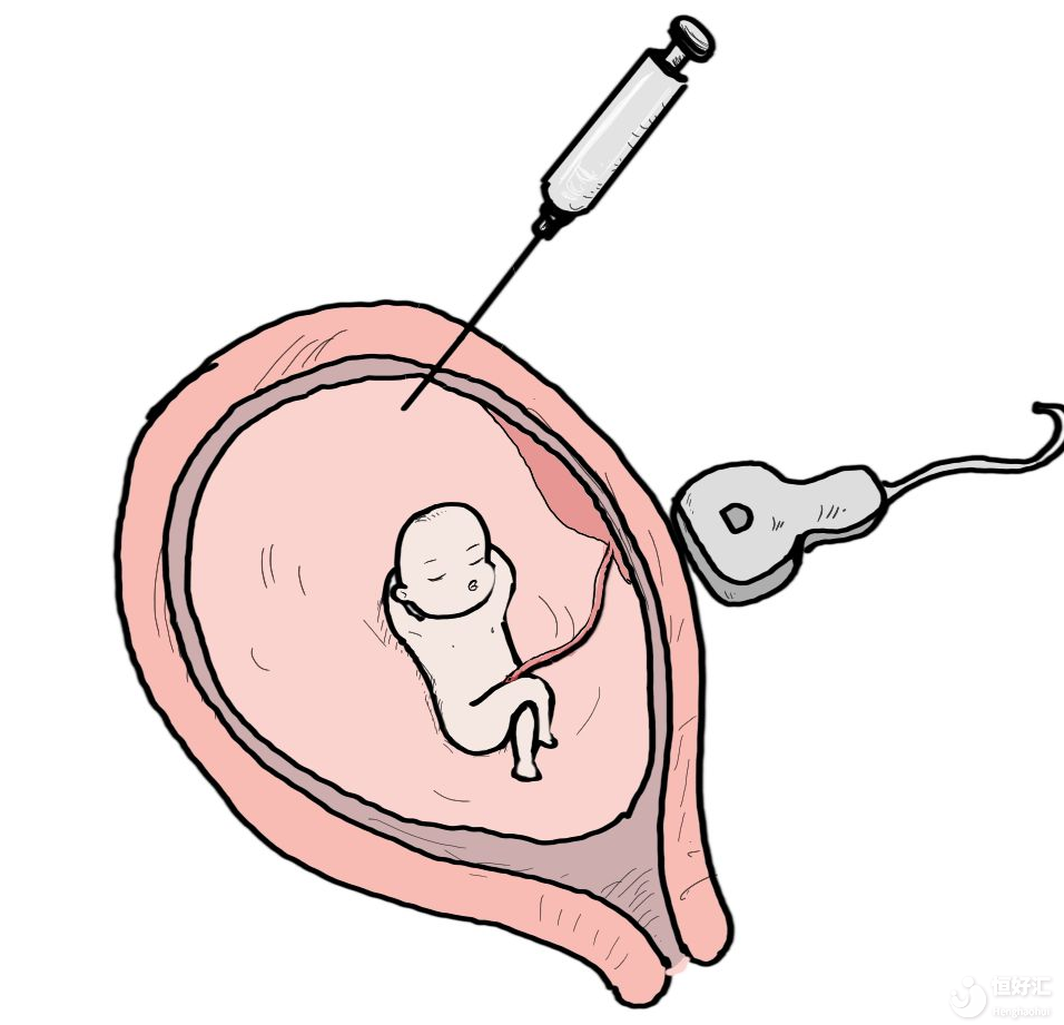 羊水穿刺，會(huì)損害到胎兒?jiǎn)幔? /></a>
	<div   id=