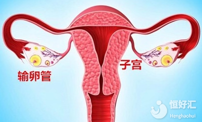 輸卵管通不通，原來可以這樣查！