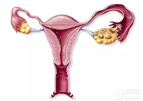 黃體功能不全性不孕能否做試管嬰兒？