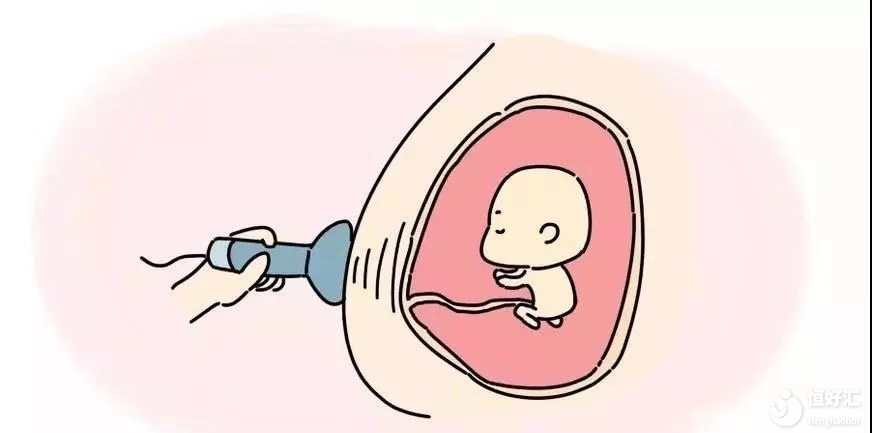 為什么要做NT檢查，有什么好處嗎？