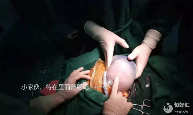 36歲孕婦產(chǎn)下“透明蛋”！難道人類物種發(fā)生了變異？