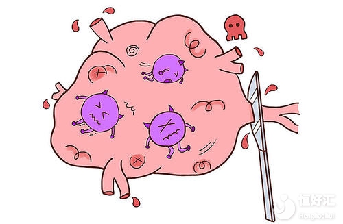 答疑解惑：怎樣才算是子宮內膜增生？如何診斷內膜增生？