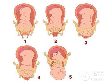 懷孕既幸福又忐忑，關于孕期變化，你中了幾個？