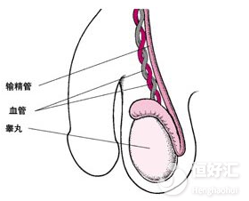 輸精管堵塞或許是跟這些原因有關，請記得遠離！