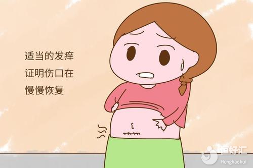剖腹產(chǎn)孕媽注意了！產(chǎn)后這樣護理助你快速恢復(fù)
