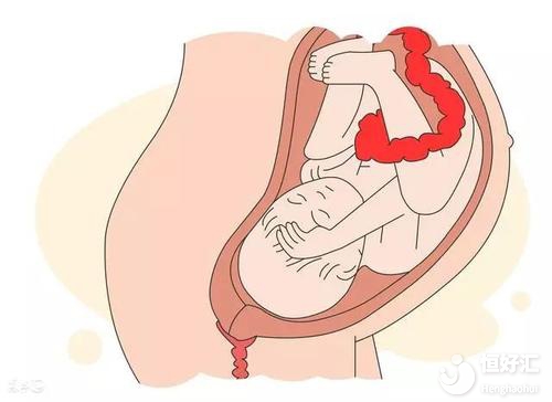 胎兒遲遲不入盆不知所措？或許你可以這樣做