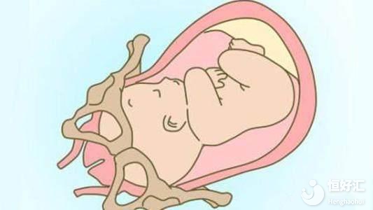 胎兒入盆會有感覺嗎？這幾點也許你想不到