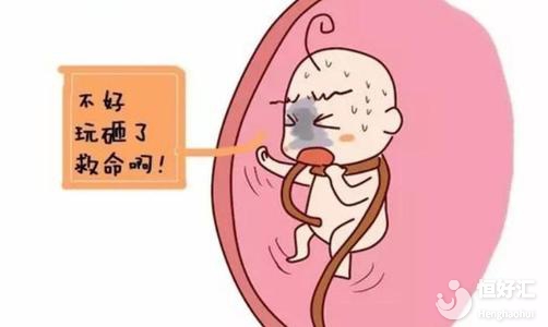 臍帶繞頸怎么辦？做好這4點(diǎn)助你巧妙緩解