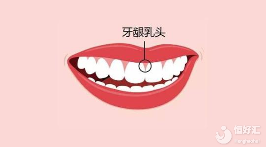 懷孕期間如何避免牙齦??？過來人勸你這樣做