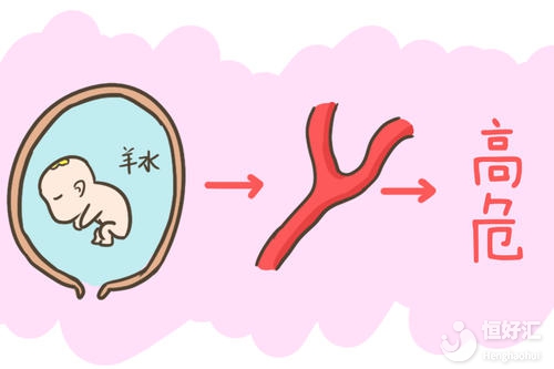 為什么醫(yī)生會(huì)害怕產(chǎn)婦咳嗽？其原因不敢相信
