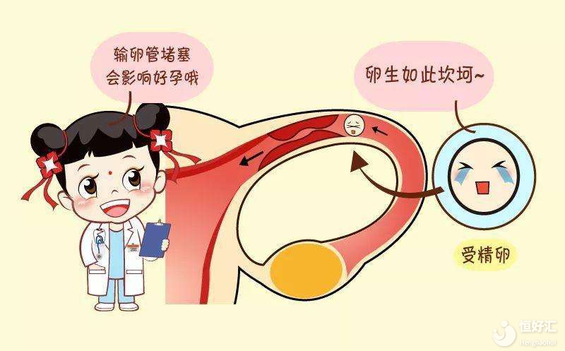 輸卵管阻塞了，我還能懷孕嗎？