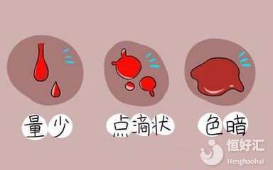 陰道出血不知所措？醫(yī)生提醒你警惕這種情況！