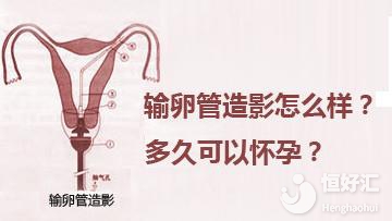 輸卵管造影很疼嗎？危害大不大？醫(yī)生這樣說……