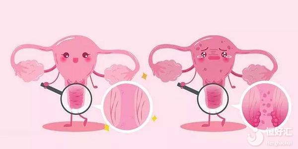 注意了！陰道出血或許和這2點有關(guān)，請警惕