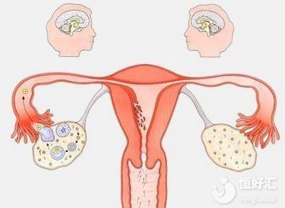 這就卵巢早衰了？中醫(yī)治療如何改善卵巢功能？