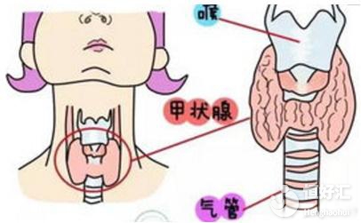 試管嬰兒為什么要查甲狀腺功能？醫(yī)生：圖的是這個(gè)