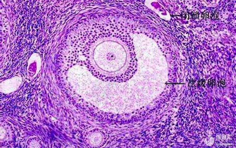 馬來(lái)西亞試管促排卵期間，卵泡早排的原因及應(yīng)對(duì)方法