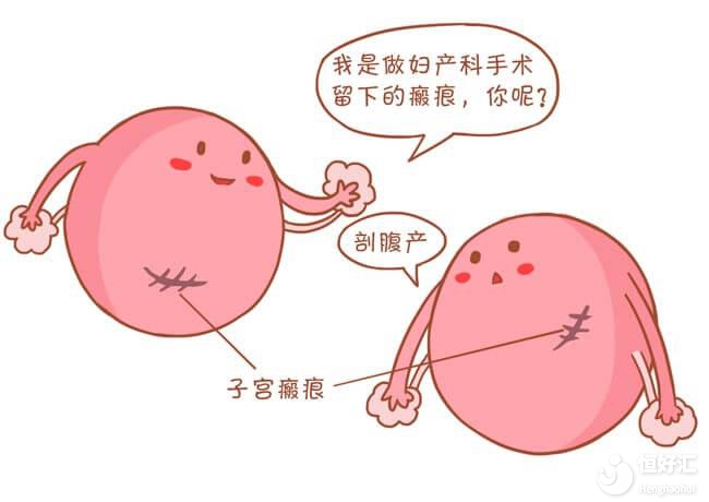 瘢痕子宮是什么？能做試管嬰兒?jiǎn)幔? />
									<div   id=