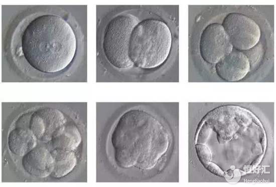 輔助生殖中的養(yǎng)囊是什么？會(huì)使高齡試管成功率變高嗎？